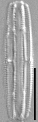 Tursiocola costata LM4 r
