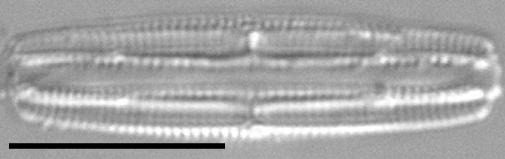 Tursiocola costata LM4 r