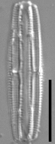 Tursiocola costata LM4
