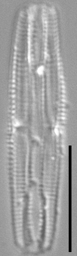 Tursiocola costata LM5 r