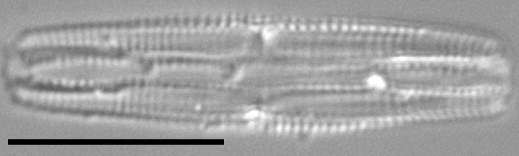 Tursiocola costata LM5 r