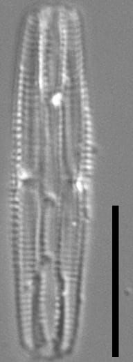 Tursiocola costata LM5