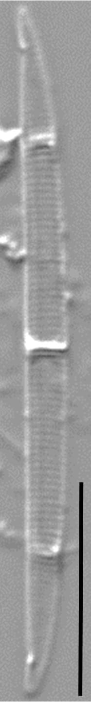 Tursiocola cymbelloides LM1