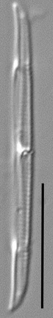 Tursiocola cymbelloides LM2