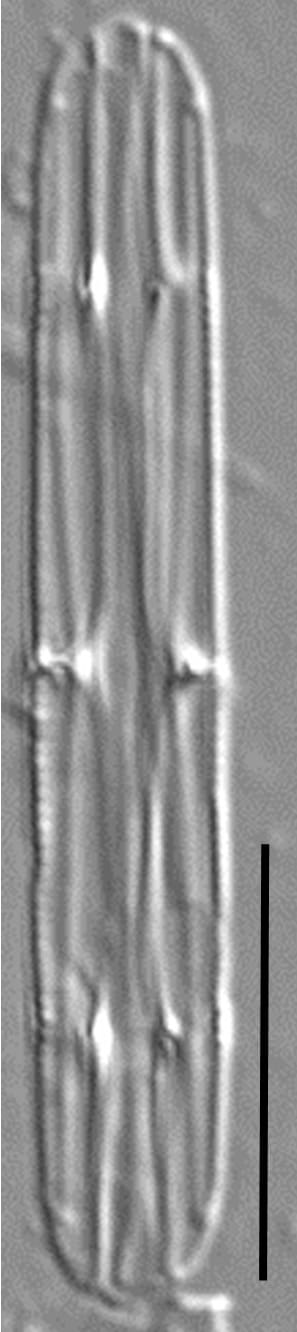 Tursiocola cymbelloides LM3