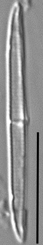 Tursiocola cymbelloides LM4