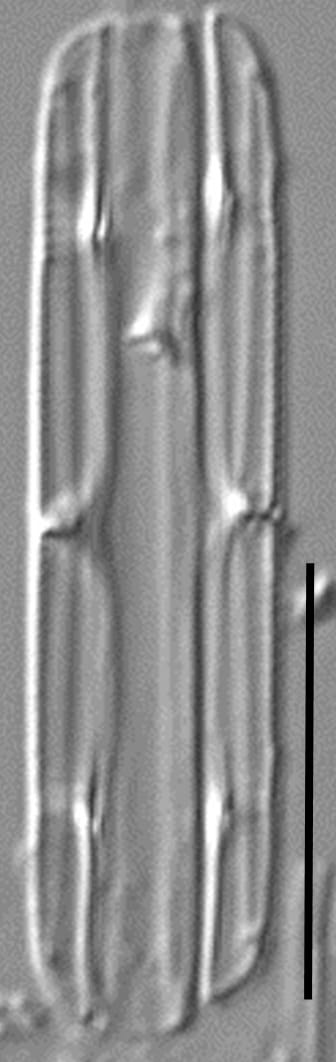 Tursiocola cymbelloides LM5