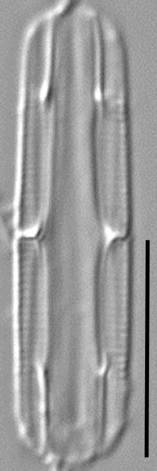 Tursiocola cymbelloides LM6