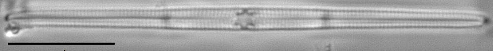 Tursiocola gracilis LM1