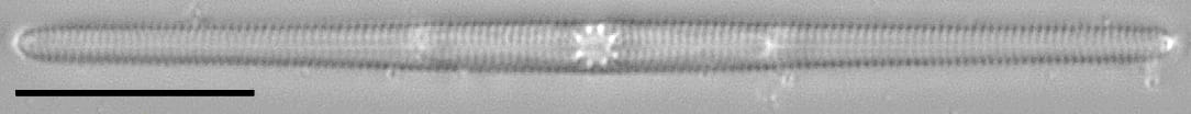 Tursiocola gracilis LM2