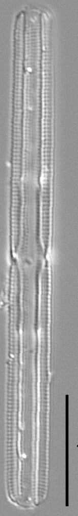 Tursiocola gracilis LM5