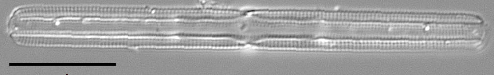 Tursiocola gracilis LM5