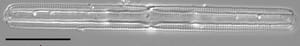 Tursiocola gracilis LM5
