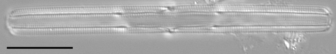 Tursiocola gracilis LM6