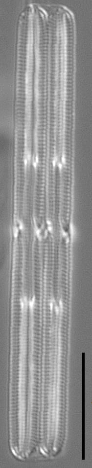 Tursiocola gracilis LM7