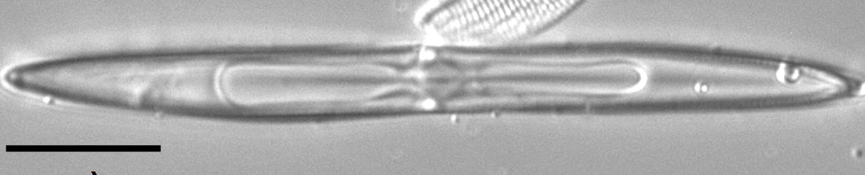 Tursiocola varicopulifera LM2