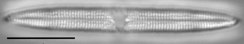 Tursiocola varicopulifera LM3