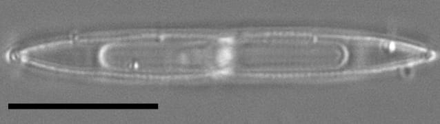 Tursiocola varicopulifera LM4