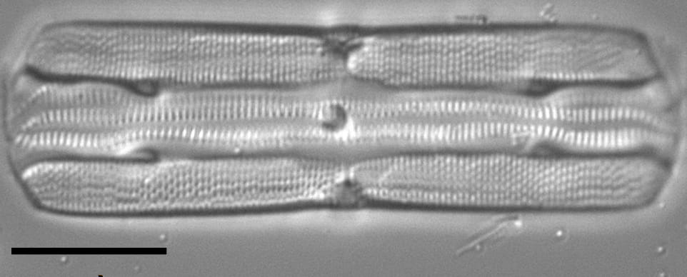 Tursiocola varicopulifera LM5