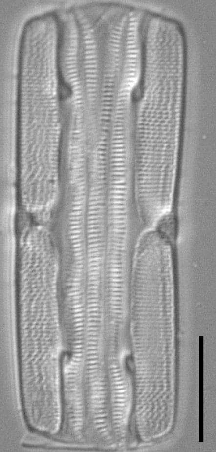 Tursiocola varicopulifera LM6