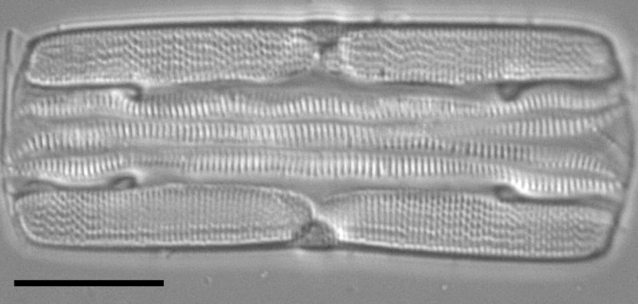 Tursiocola varicopulifera LM6