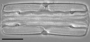 Tursiocola varicopulifera LM6