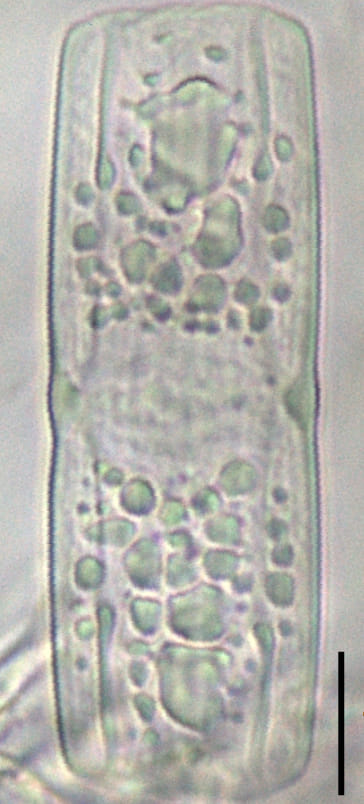 Tursiocola varicopulifera LM7