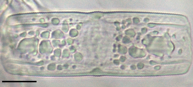 Tursiocola varicopulifera LM7