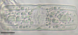 Tursiocola varicopulifera LM7