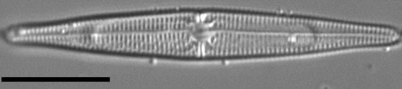 Tursiocola ziemanii LM1