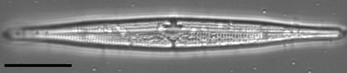 Tursiocola ziemanii LM2