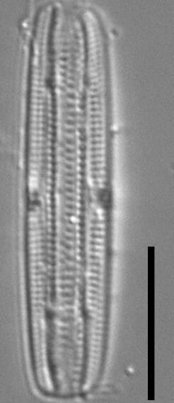 Tursiocola ziemanii LM5