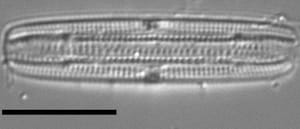 Tursiocola ziemanii LM5