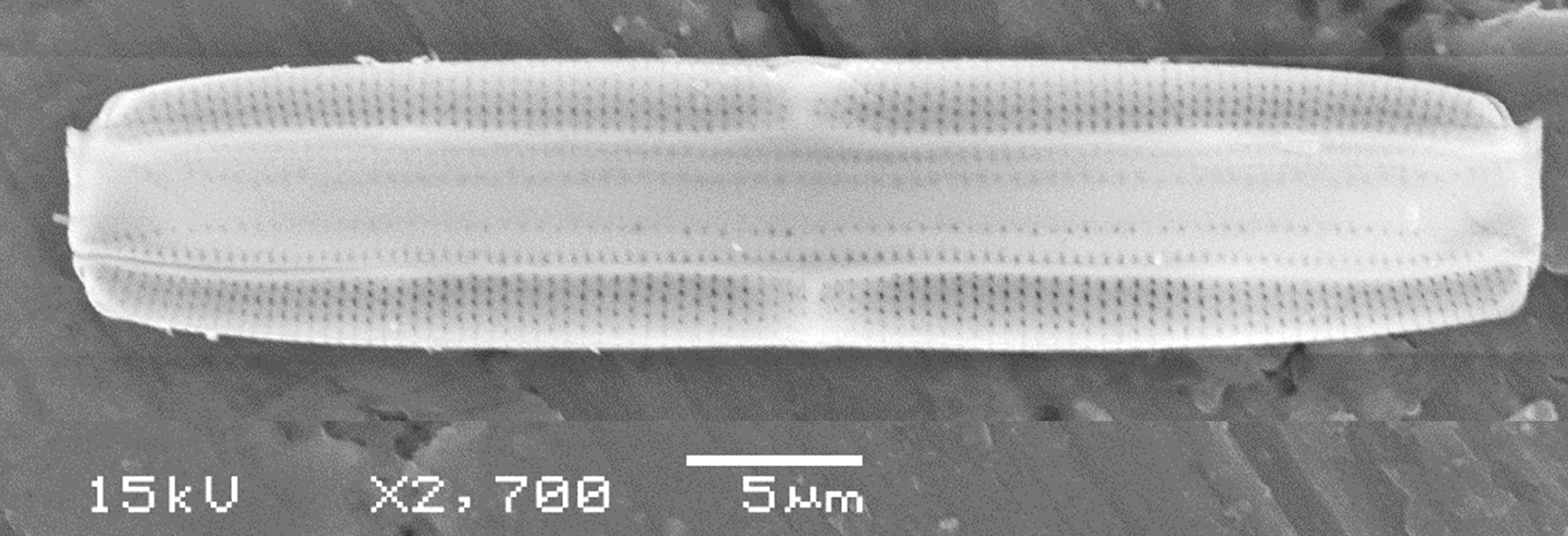 Tursiocola ziemanii SEM1