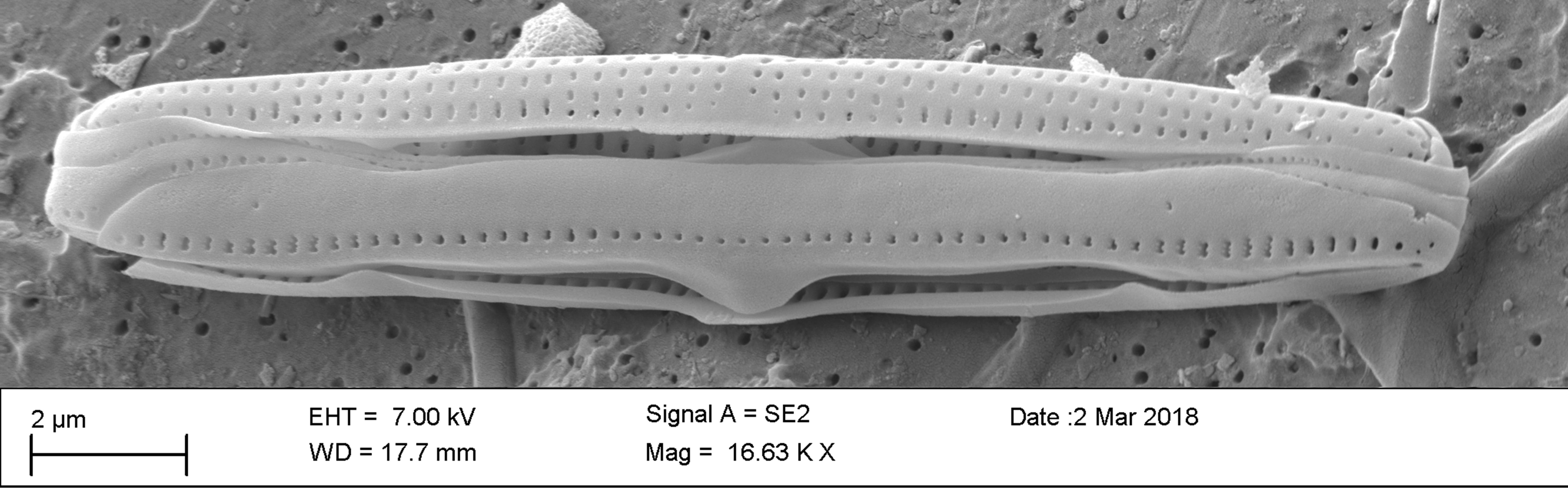 Tursiocola ziemanii SEM2