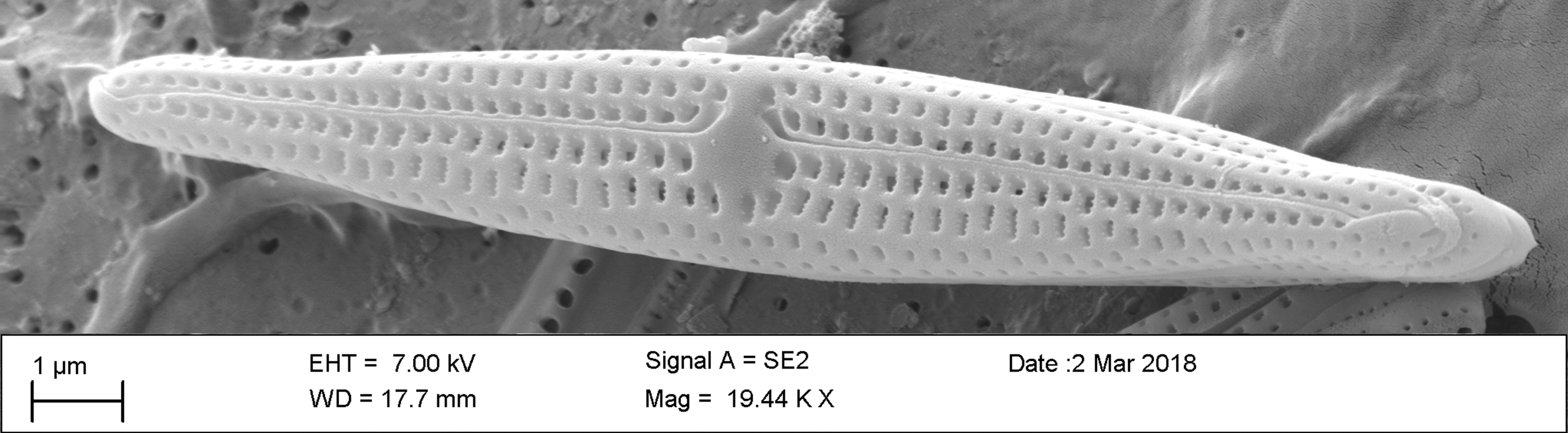 Tursiocola ziemanii SEM3