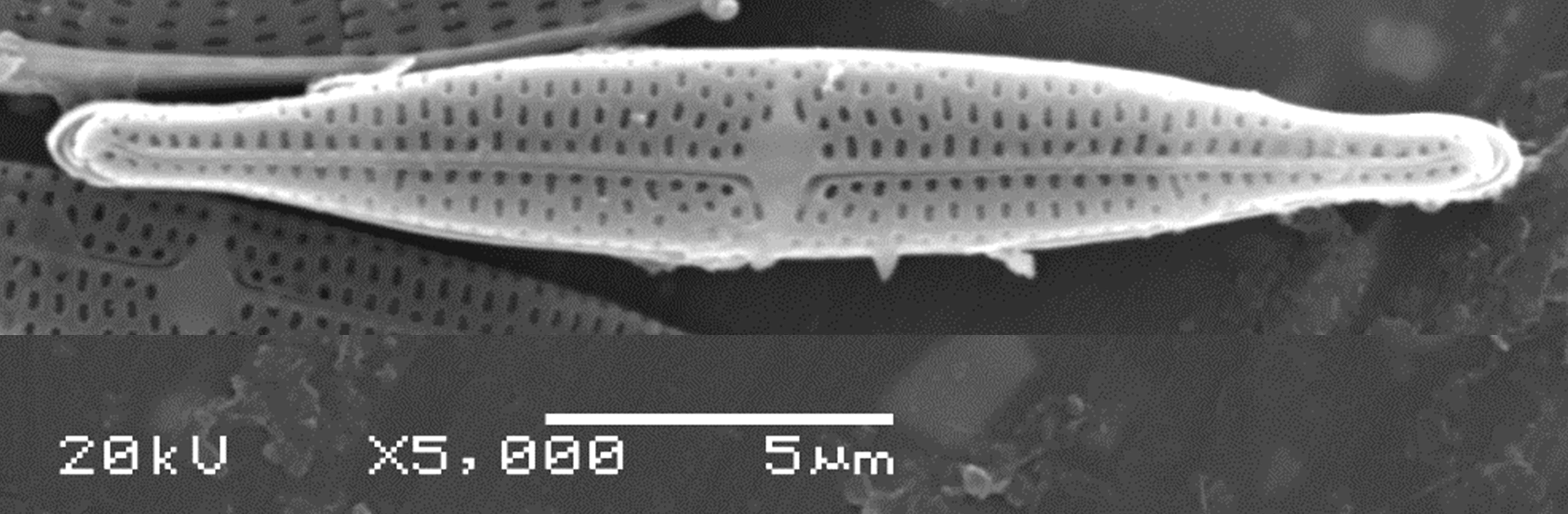 Tursiocola ziemanii SEM4