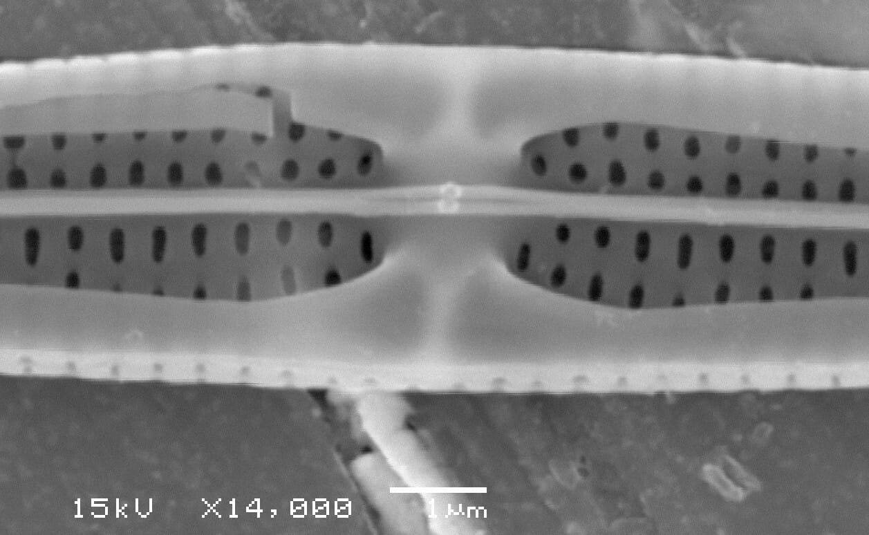 Tursiocola ziemanii SEM5