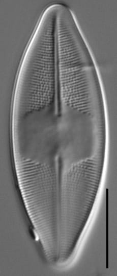 Eucocconeis americana LM1