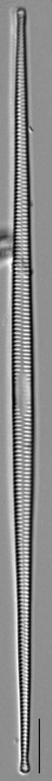 Ulnaria sp IT ILL 2015 LM2