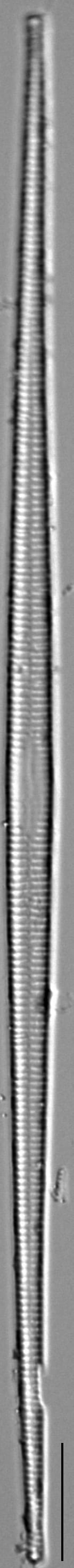 Ulnaria sp IT ILL 2015 LM3