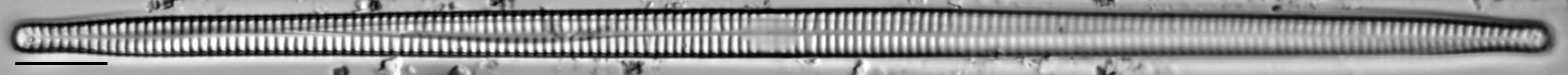 Ulnaria delicatissima LM21