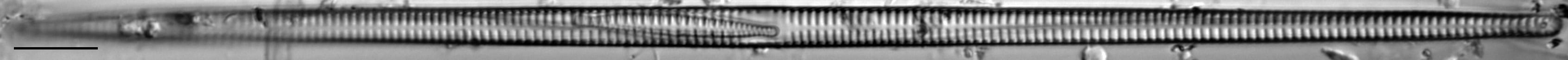 Ulnaria delicatissima LM19