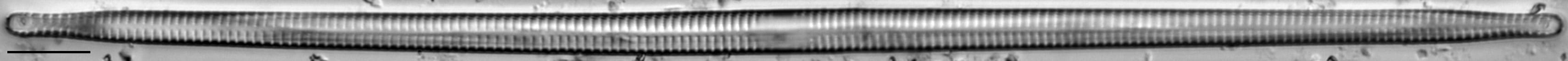 Ulnaria delicatissima LM18