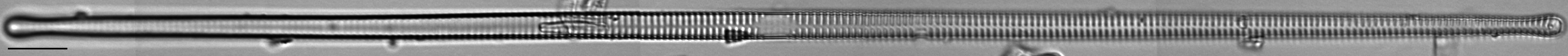 Ulnaria delicatissima LM15