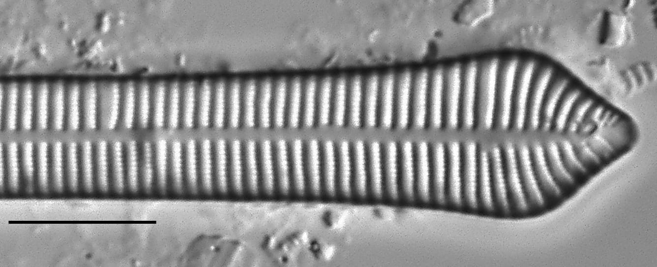 Ulnaria Capitata LM7