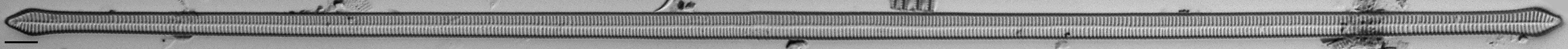 Ulnaria Capitata LM1