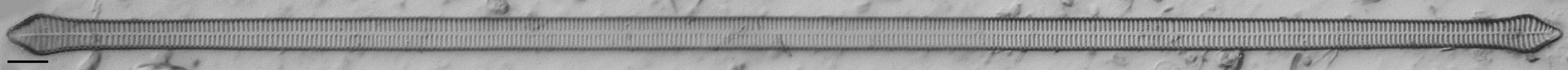Ulnaria Capitata LM3