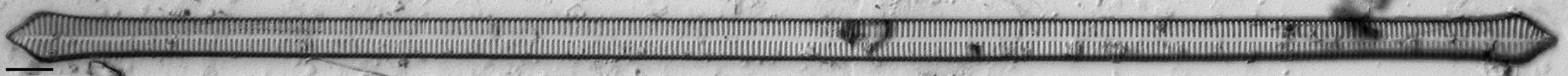 Ulnaria Capitata LM4