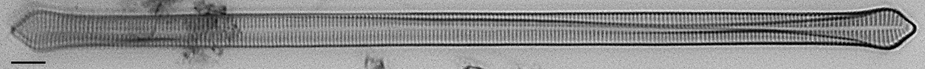 Ulnaria Capitata LM5